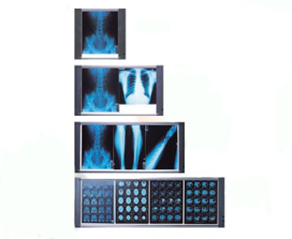 X ray viewer slim